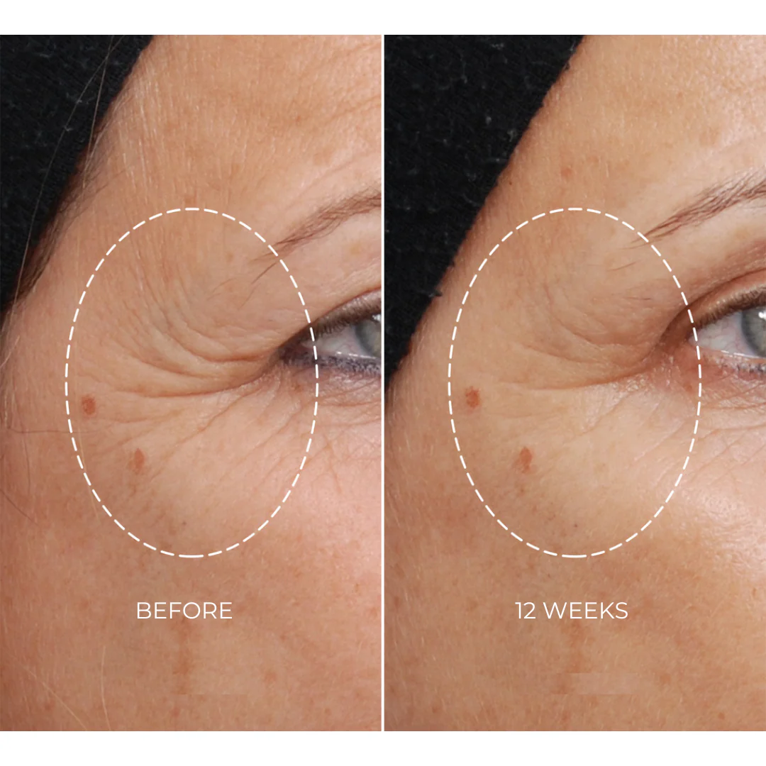 NEWA Plus - Advanced Kit - Image 3