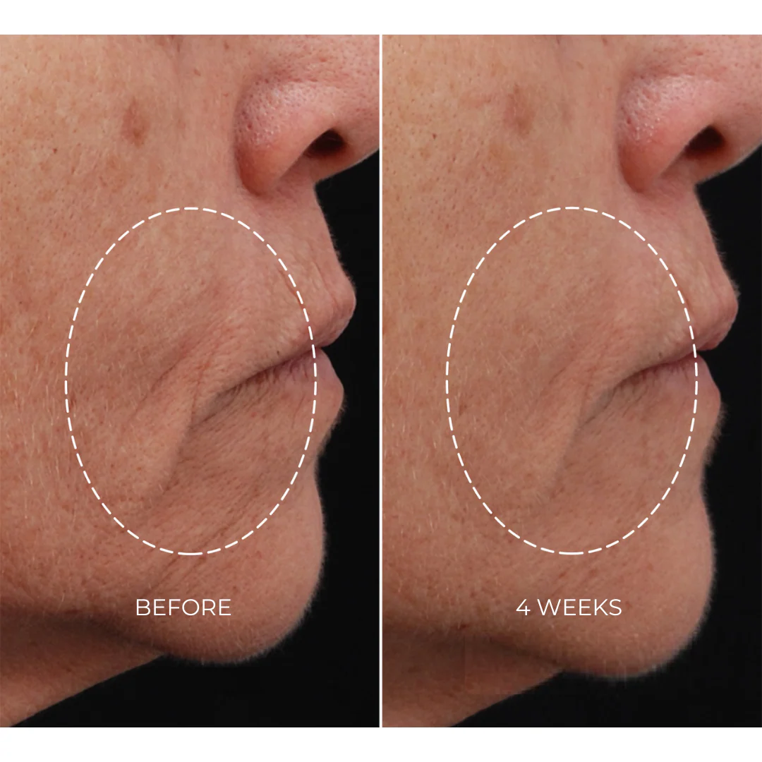 NEWA Plus - Advanced Kit - Image 5